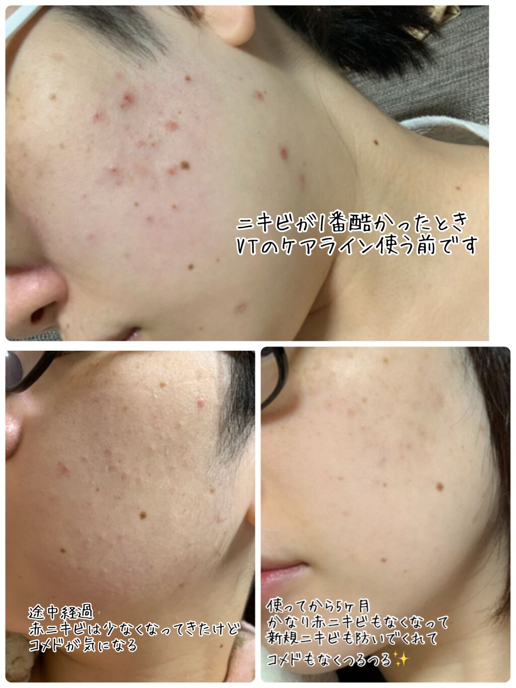 CICA クリーム/VT/フェイスクリームを使ったクチコミ(2枚目)