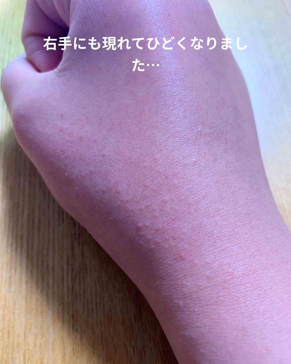 白色ワセリン(医薬品)/健栄製薬/その他を使ったクチコミ(3枚目)