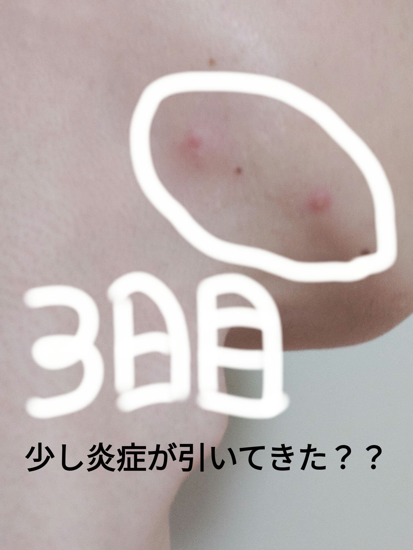 メンズビオレ ザフェイス　毛穴汚れクリア/メンズビオレ/泡洗顔を使ったクチコミ（1枚目）