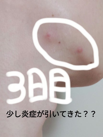 メンズビオレ ザフェイス 毛穴汚れクリア/メンズビオレ/泡洗顔を使ったクチコミ(1枚目)