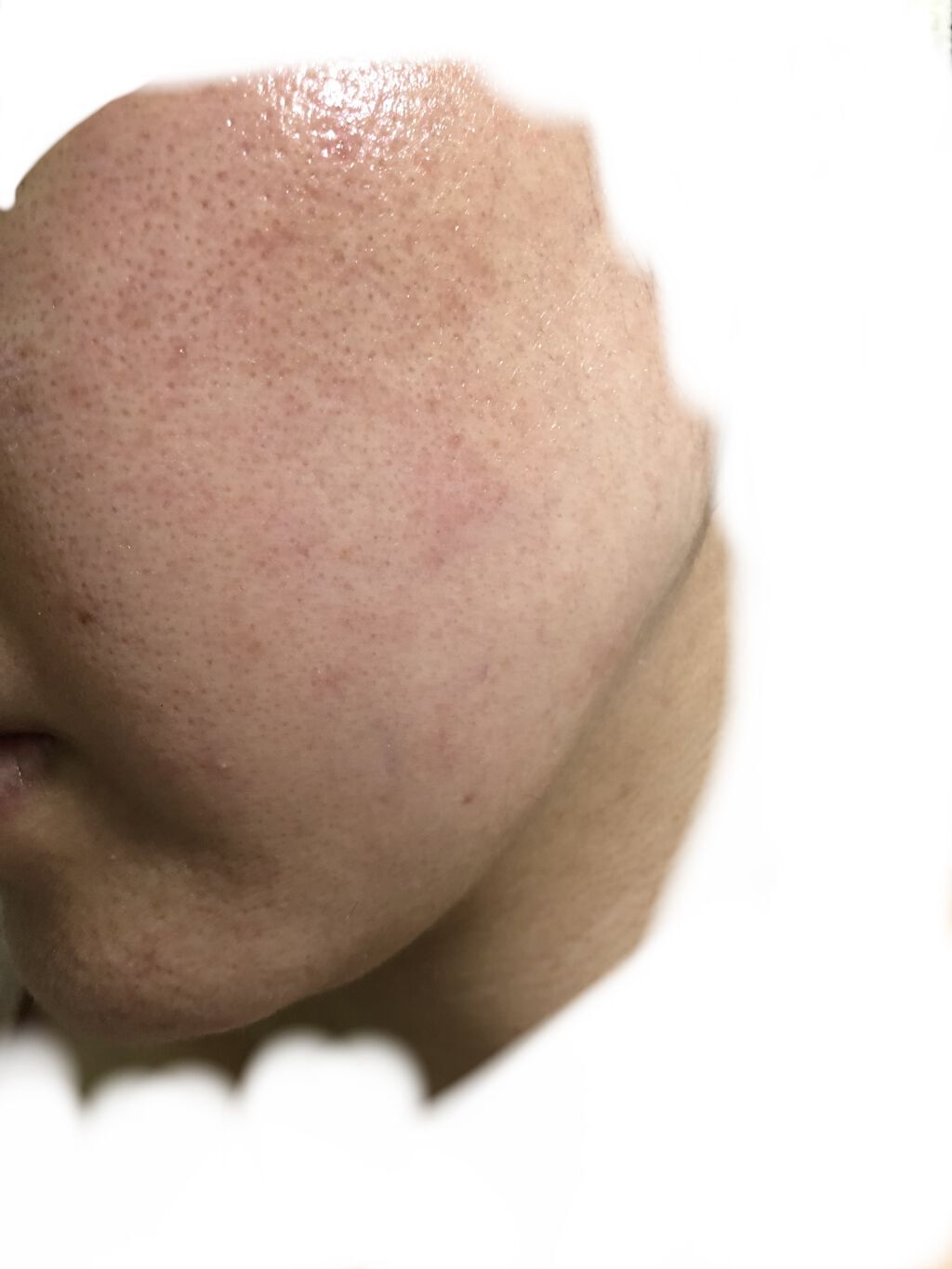 極潤 ヒアルロン液 ライトタイプ/肌ラボ/化粧水を使ったクチコミ（1枚目）