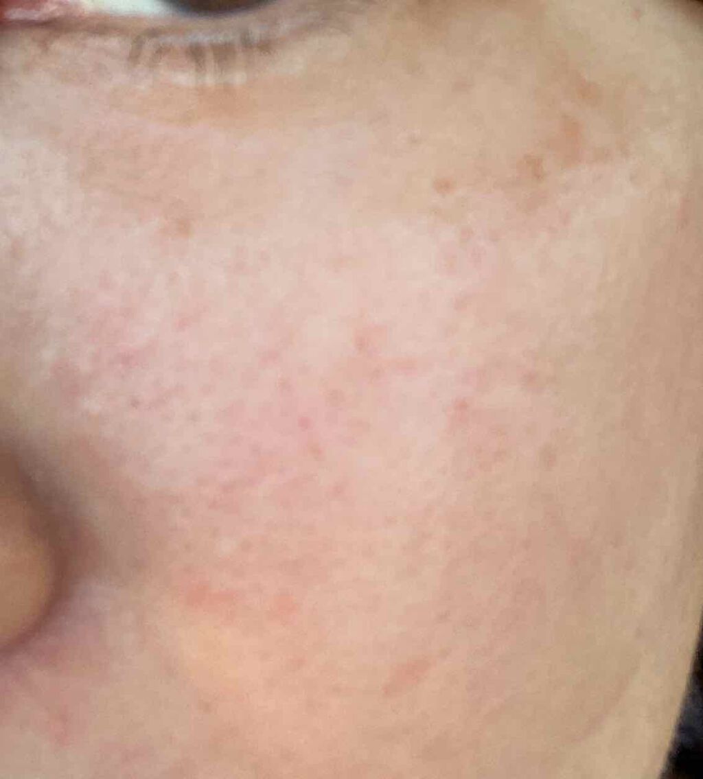 導入化粧液/無印良品/ブースター・導入液を使ったクチコミ（2枚目）