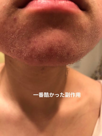 ããã on LIPS ãð§¡ãããªã²ã«1ã¶æäœ¿çšð§¡ããã«ã¡ã¯ïŒåæçš¿ã§ãðŠä»åã¯ç§ã人ç..ãïŒ4æç®ïŒ