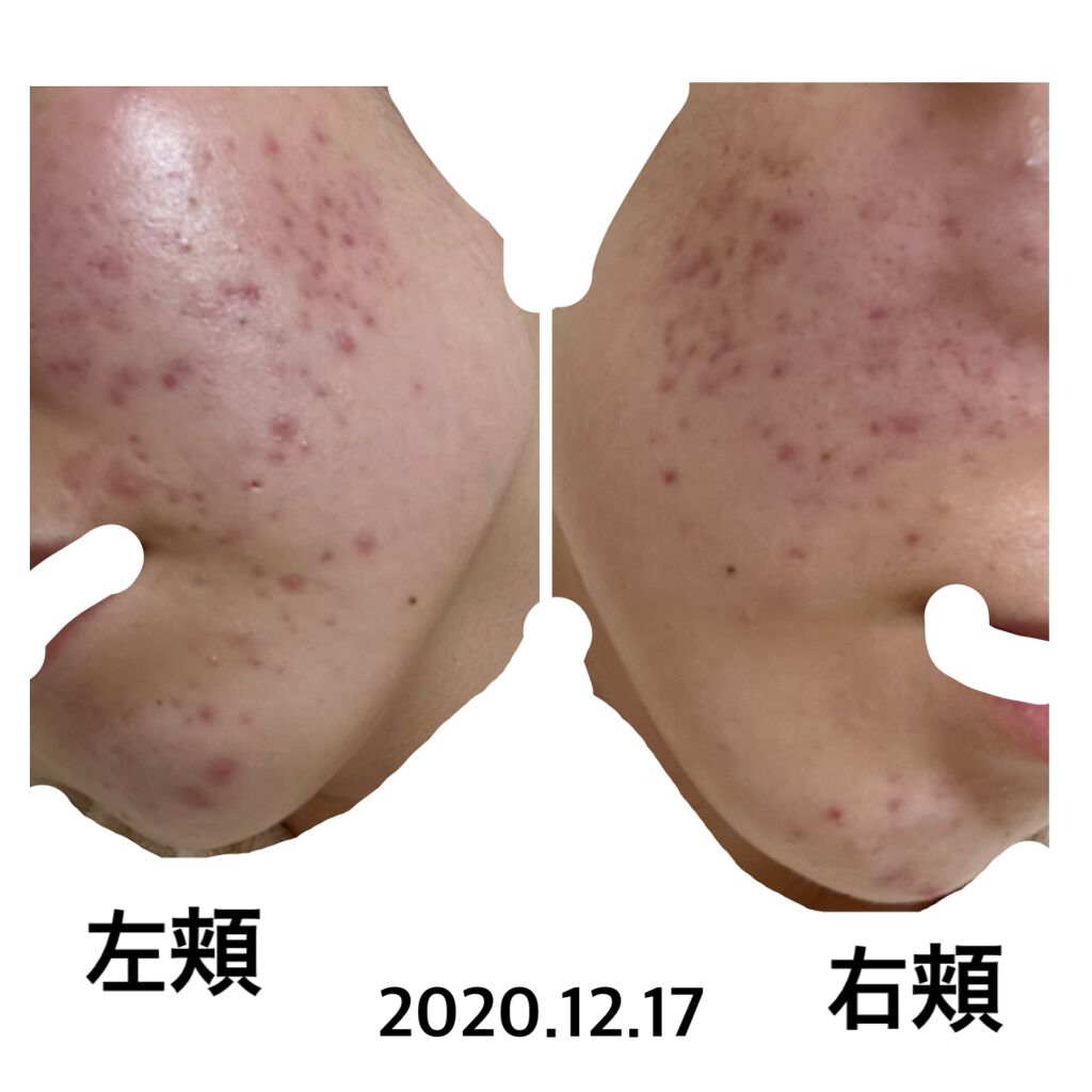 ボラージ クリーム/ちふれ/ボディクリームを使ったクチコミ(1枚目)