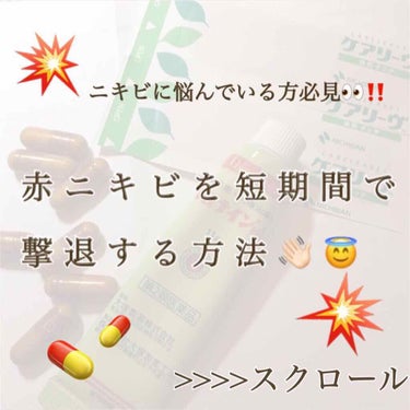 Georgeです...！！

浮上しなさすぎて死んだかと思った方、、生きてます！！！！


ひとつ前の涙袋の投稿、めっちゃ多くのいいねとクリップが来ていて...まじで嬉しいです、本当にありがとうございま