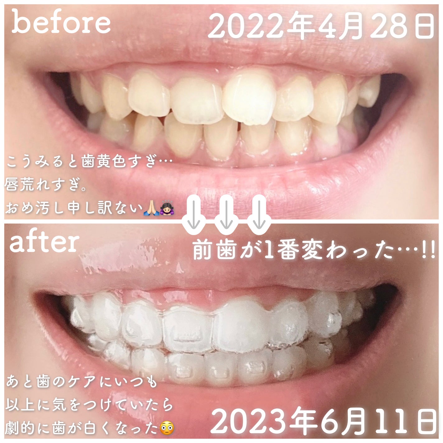 フロス/ルシェロ/デンタルフロス・歯間ブラシを使ったクチコミ(2枚目)