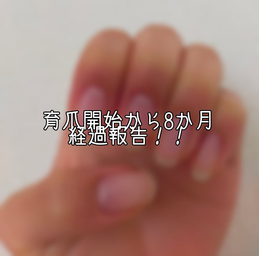 ウィンマックス キューティクルオイル/DAISO/ネイルオイル・トリートメントを使ったクチコミ（1枚目）