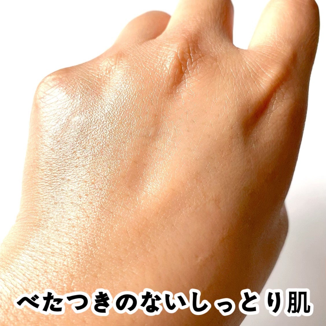 ナイアシンアミドブレミッシュケアセラム/ONE THING/美容液を使ったクチコミ(5枚目)