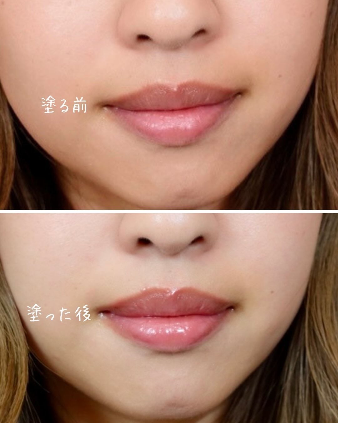 ニードルプランパー 高熱フィグ/Ui2./リッププランパーを使ったクチコミ(3枚目)