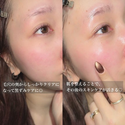 ルルルンクレンジング トーニングバーム CLEAR BLACK/ルルルン/クレンジングバームを使ったクチコミ(5枚目)