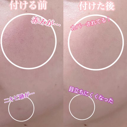 メタフィットヴィーガンクッション/AMUSE/クッションファンデーションを使ったクチコミ(3枚目)