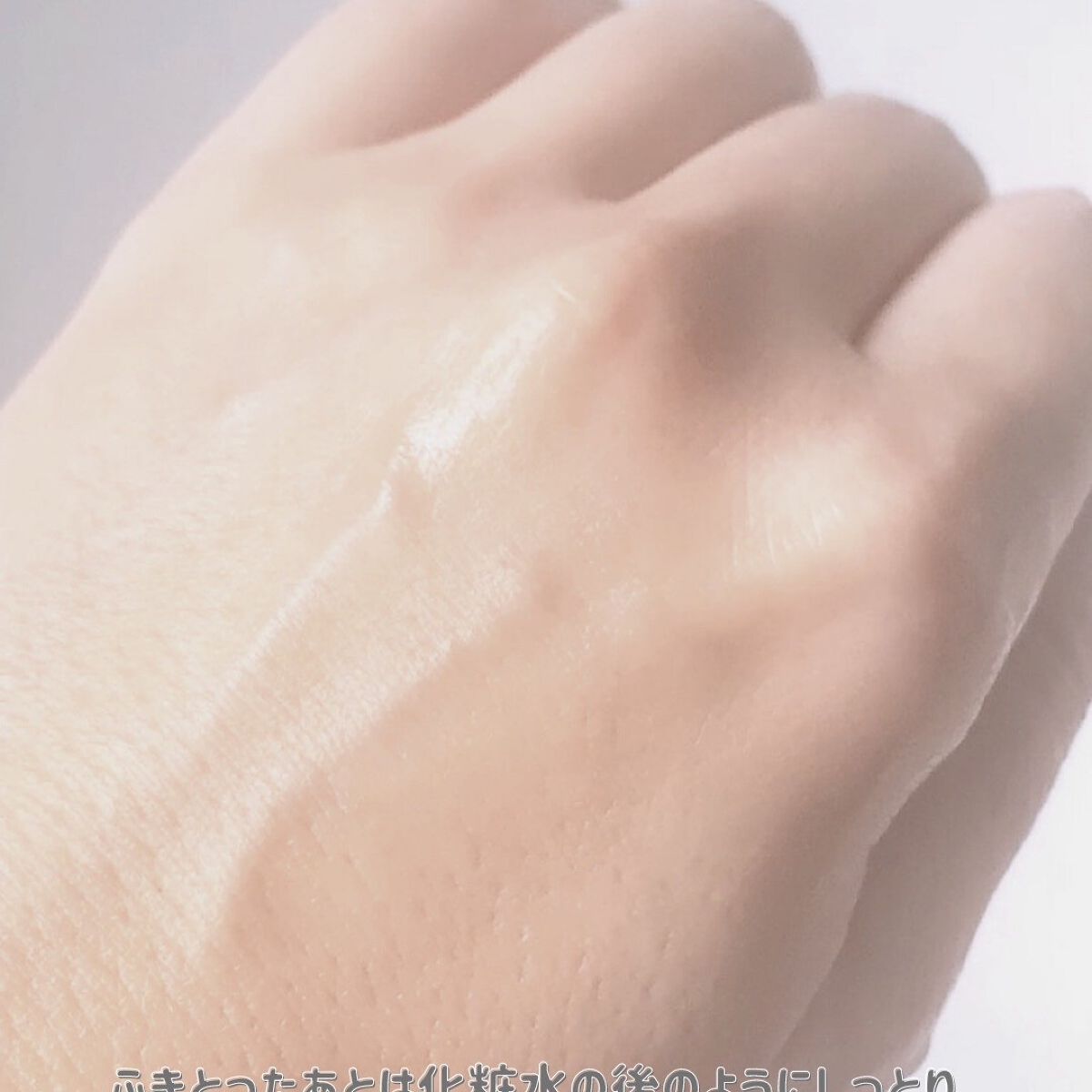 CICAピュリファイング トナー/ロベクチン/化粧水を使ったクチコミ(4枚目)