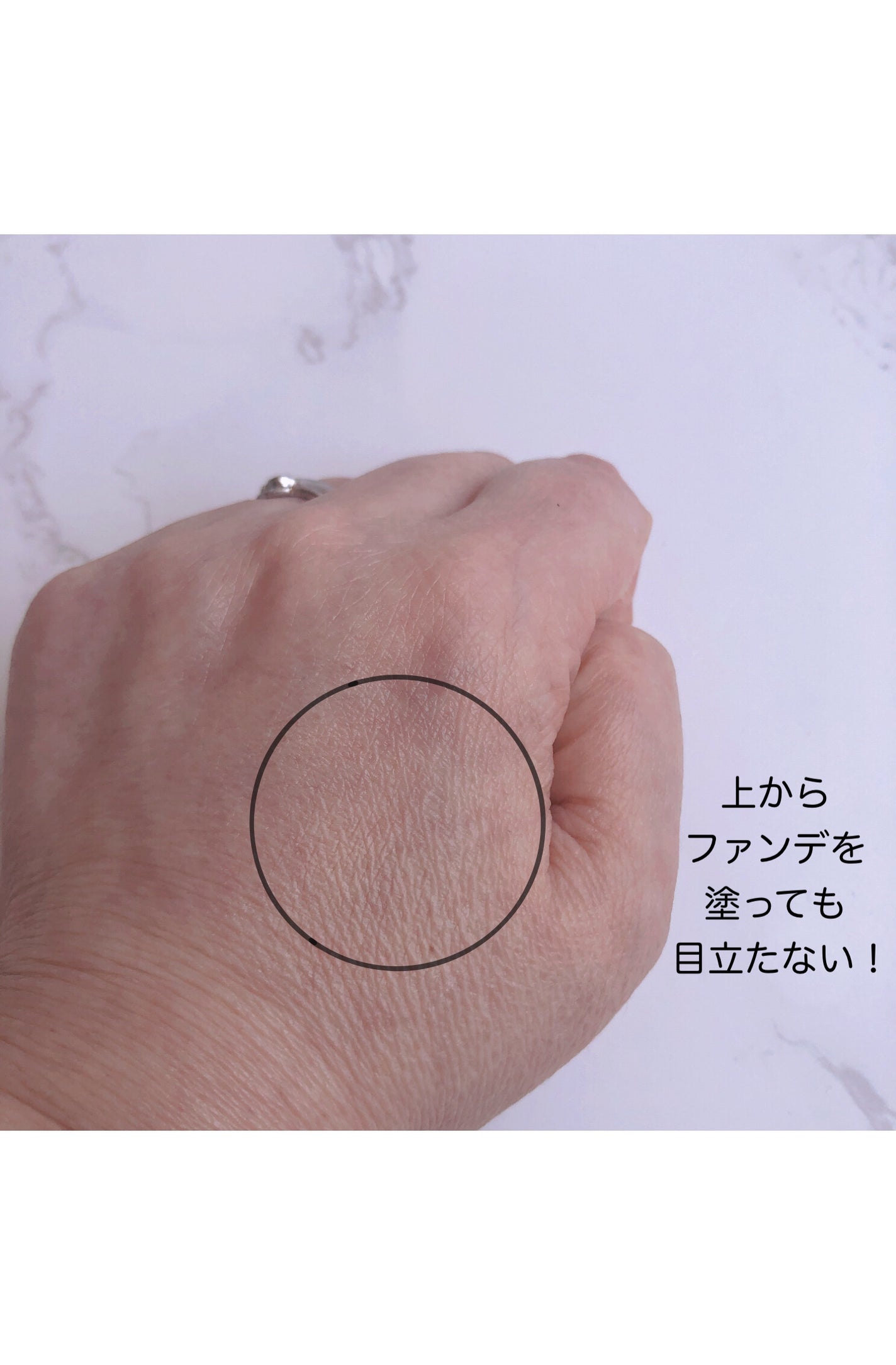 CICA method RECOVER PATCH/コジット/その他スキンケアを使ったクチコミ(4枚目)