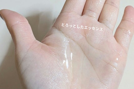 薬用ルルルン 美白アクネ/ルルルン/シートマスク・パックを使ったクチコミ(9枚目)