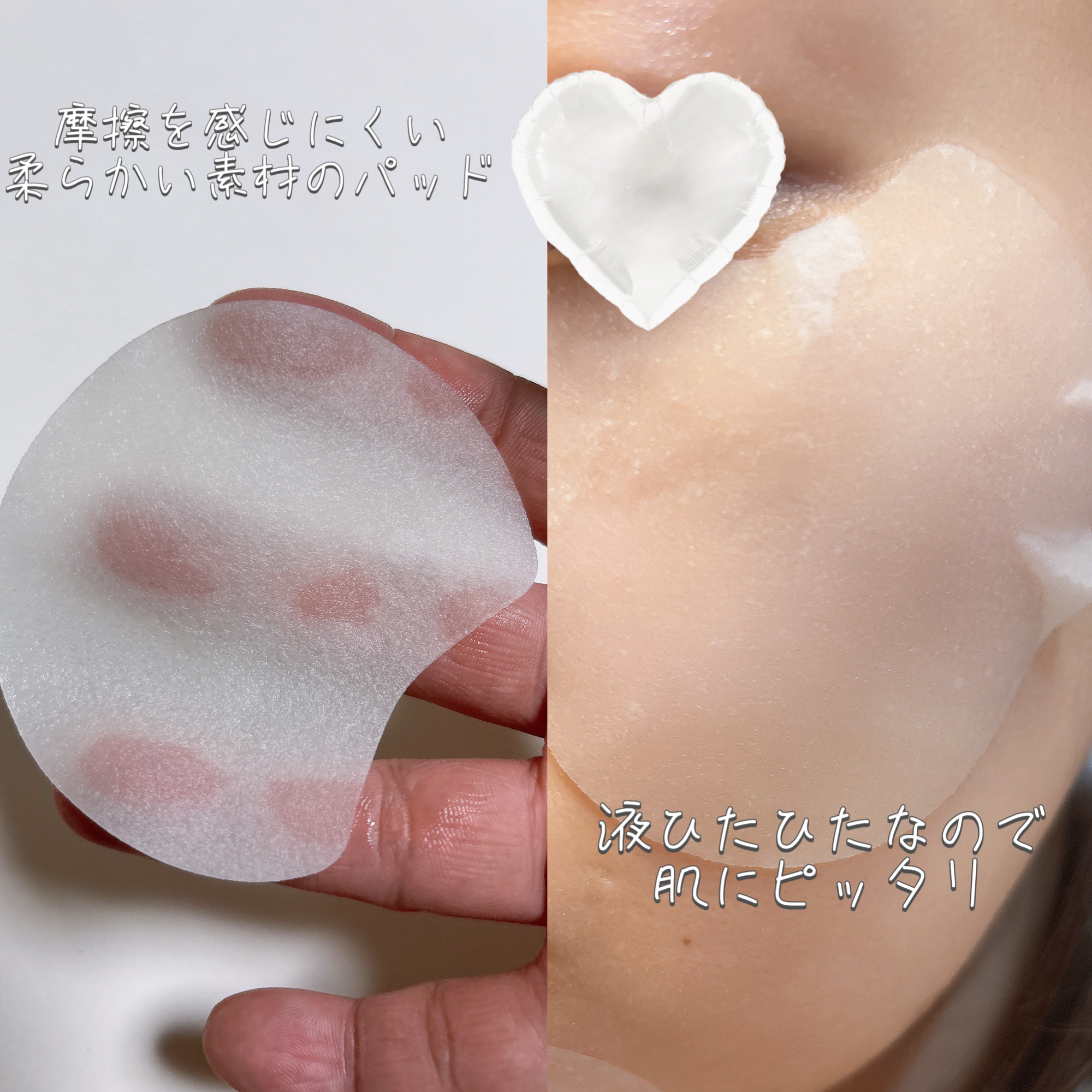 センテラ クイックカーミングパッド/SKIN1004/トナーパッドを使ったクチコミ（3枚目）