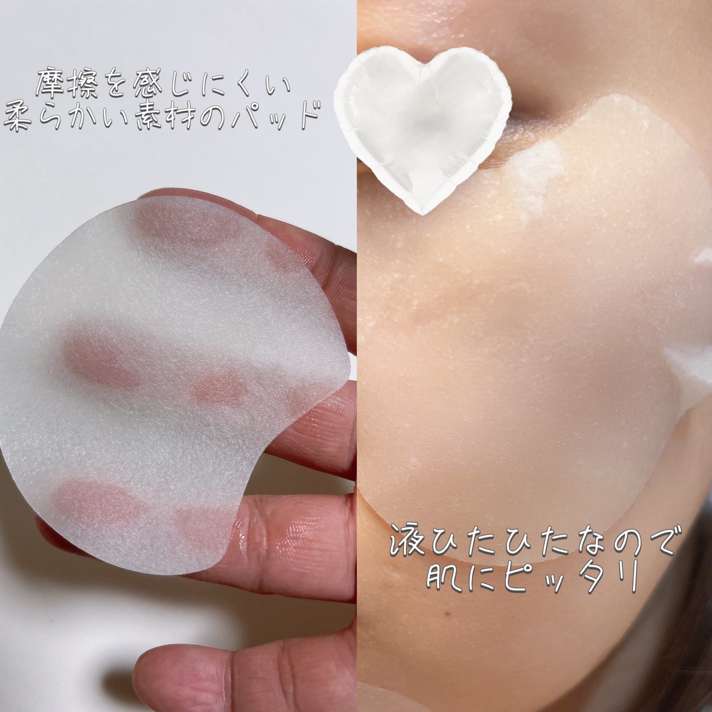 センテラ クイックカーミングパッド/SKIN1004/トナーパッドを使ったクチコミ(3枚目)