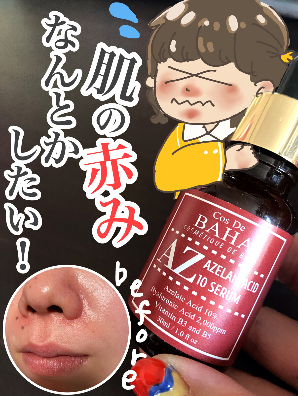 AZアゼライン酸10セラム/コスデバハ/美容液を使ったクチコミ（1枚目）