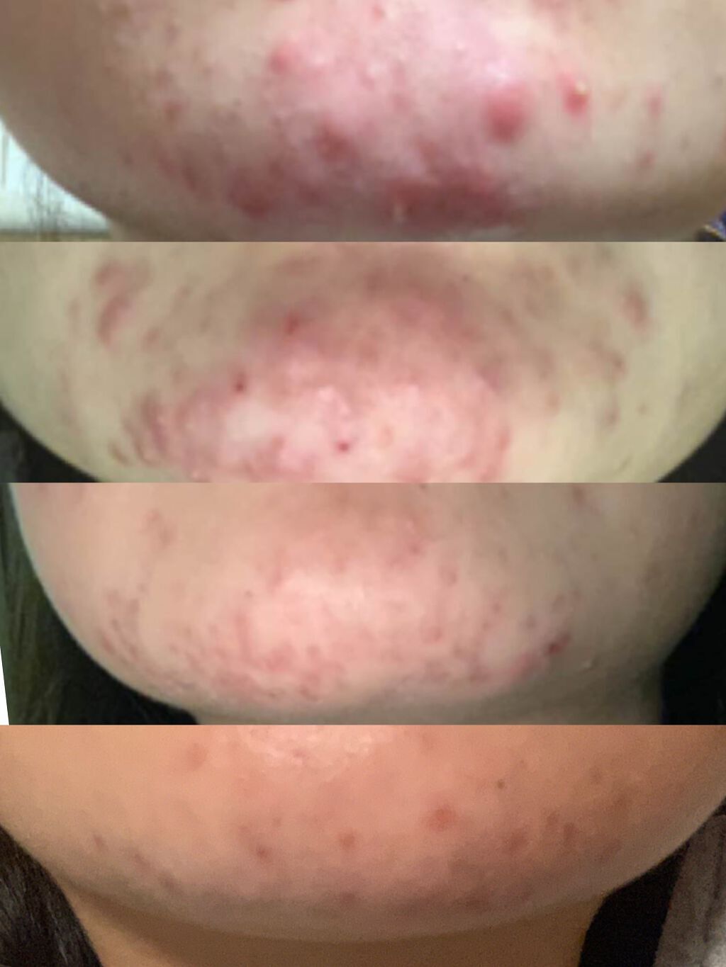 ハトムギ化粧水(ナチュリエ スキンコンディショナー R )/ナチュリエ/化粧水を使ったクチコミ（2枚目）