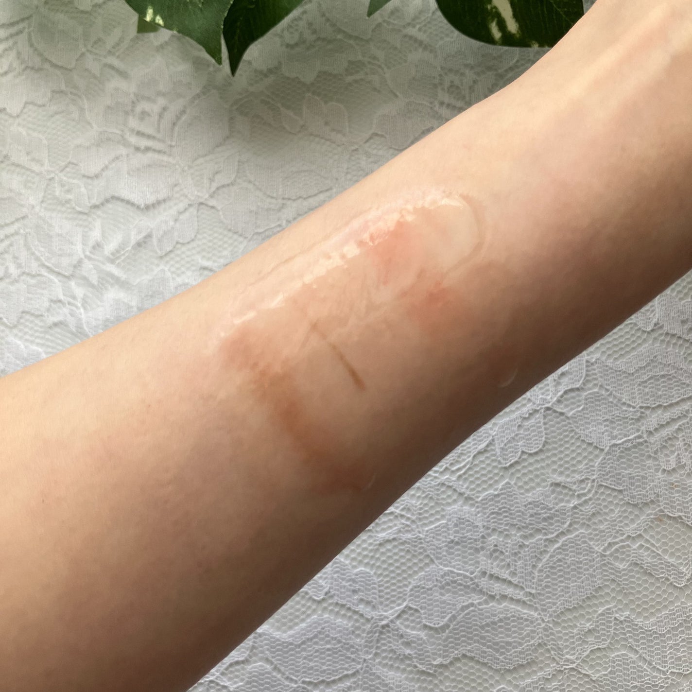 ドクダミ 77 スージングトナー/Anua/化粧水を使ったクチコミ(6枚目)