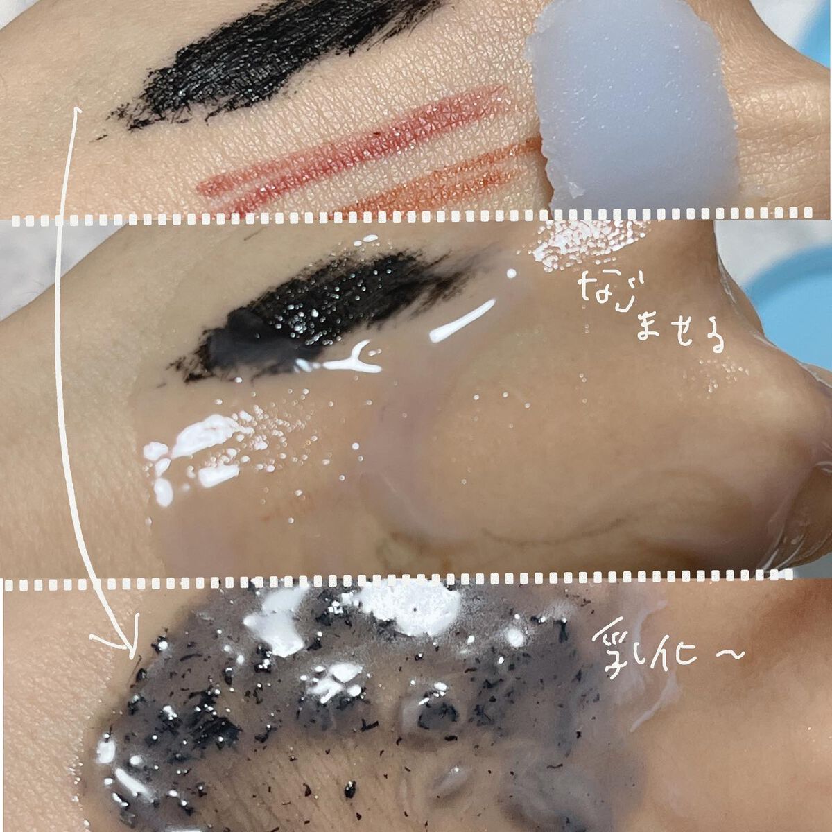 夢みるバーム アクネクリアモイスチャー/ロゼット/クレンジングバームを使ったクチコミ(6枚目)