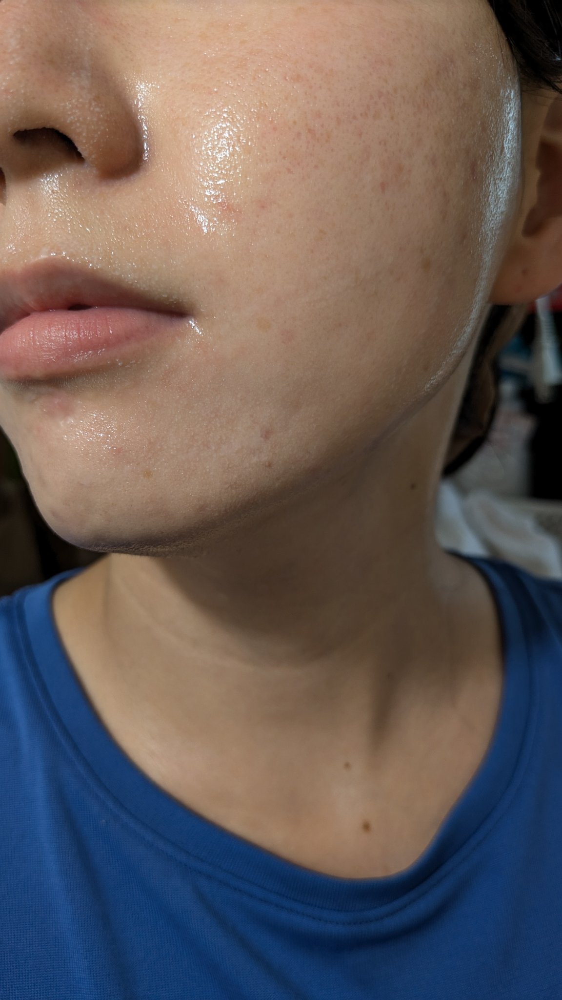 A2+NAG2ソリューション/The Ordinary/美容液を使ったクチコミ（2枚目）