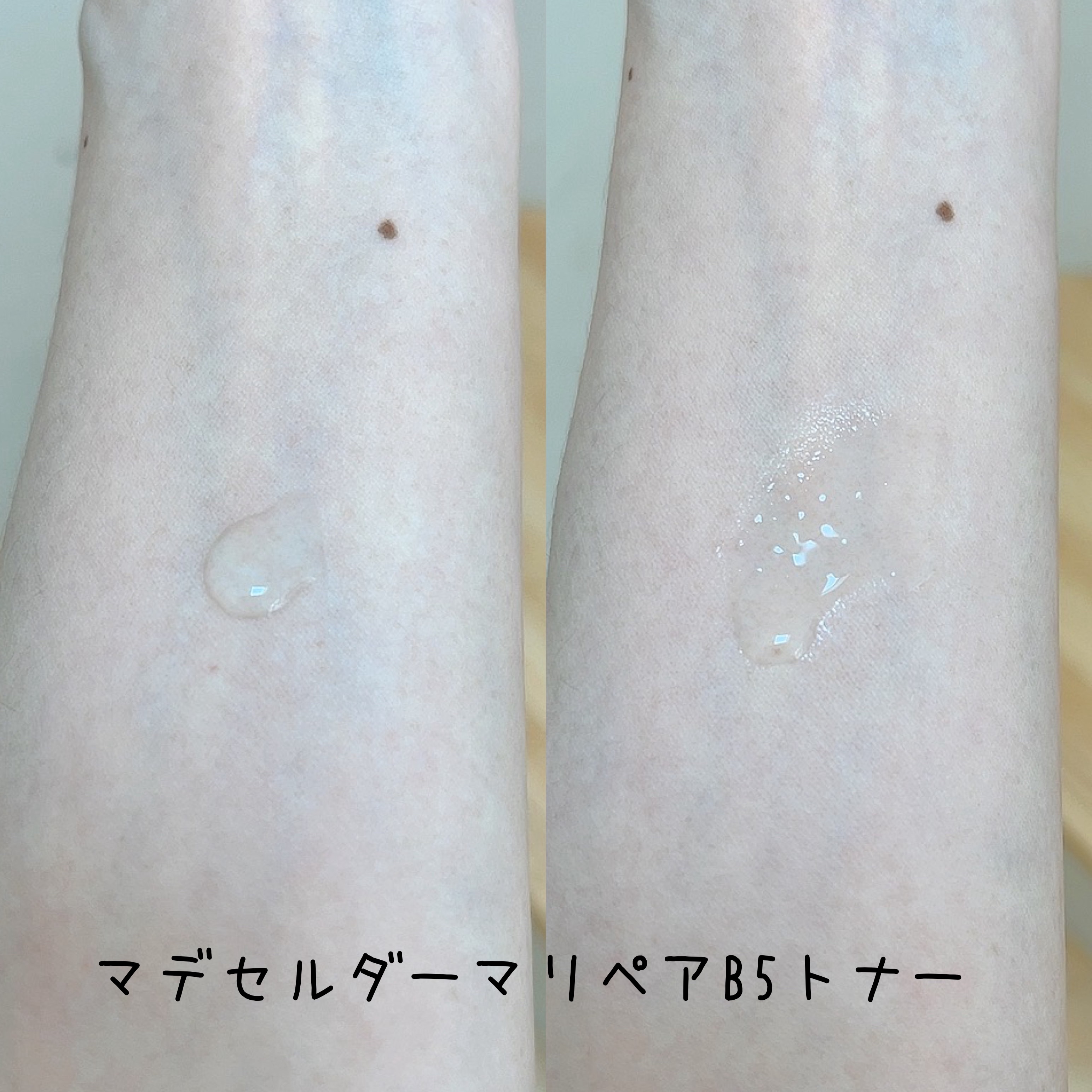 マデセルダーマリペア B5 トナー/theralogic/化粧水を使ったクチコミ（3枚目）