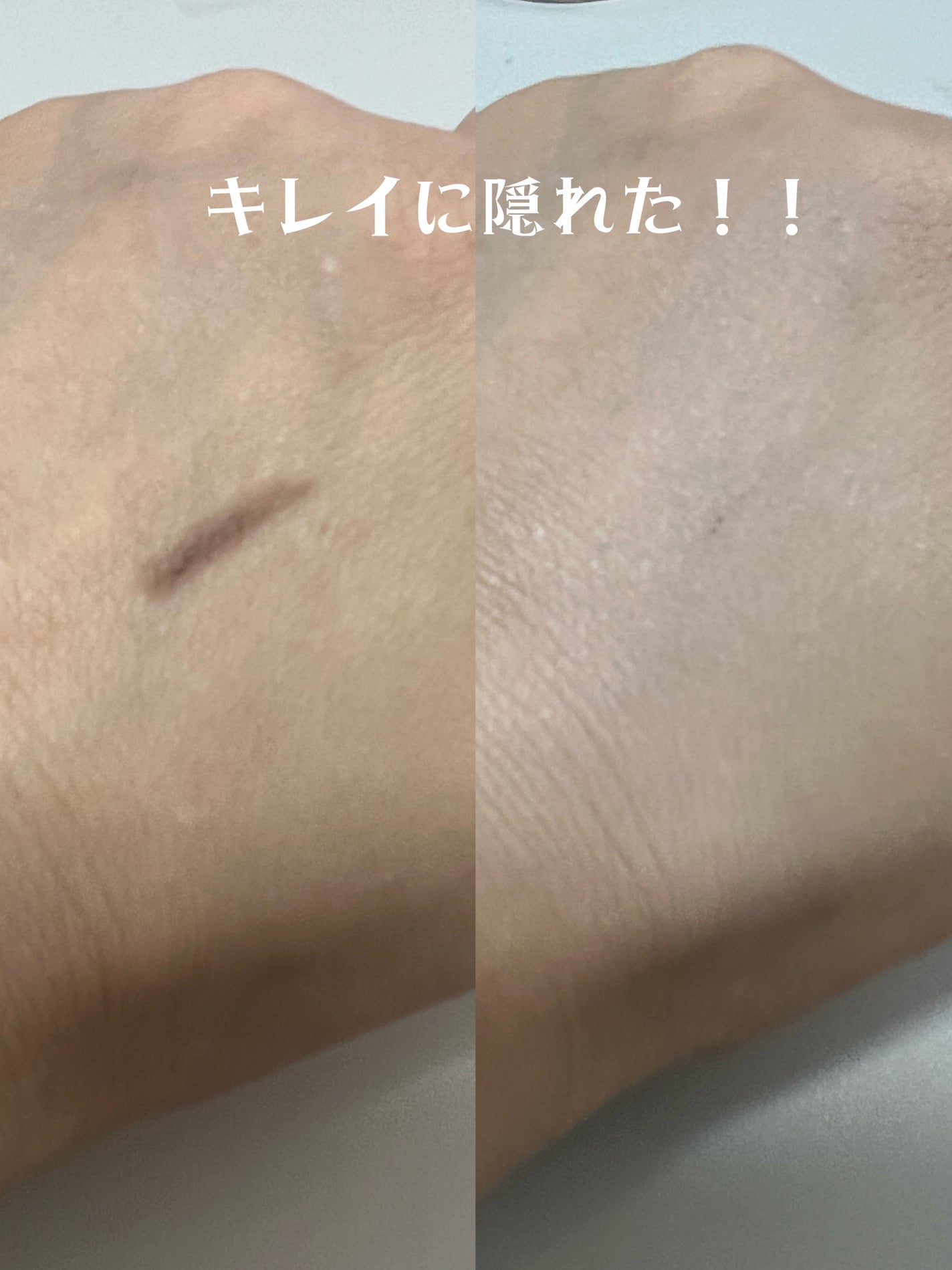 ロングラスティングチップコンシーラーフィックシングフィット/LUNA/リキッドコンシーラーを使ったクチコミ(4枚目)