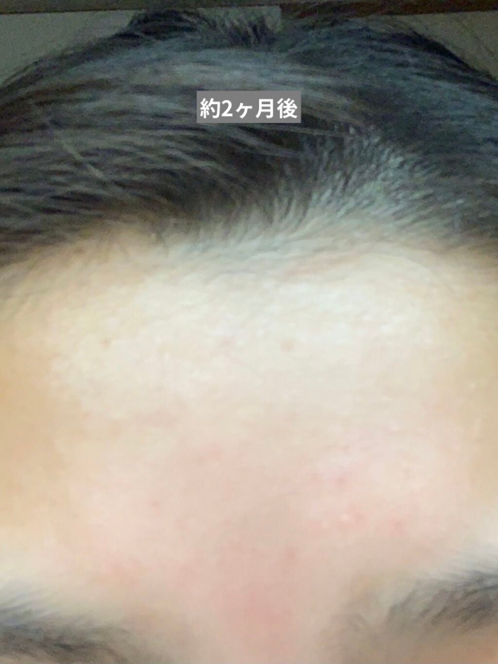 ð€ on LIPS ãæ±ãåçããããªããð§ç§ãä¹
ãã¶ãã«èŠããšèªåã§ãåŒããŸãïŒç¬..ãïŒ3æç®ïŒ