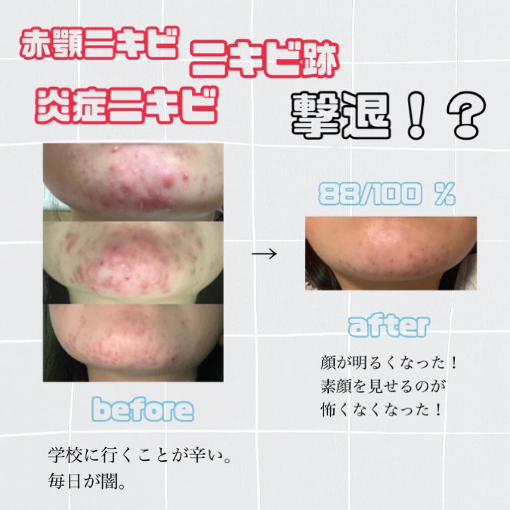 ハトムギ化粧水(ナチュリエ スキンコンディショナー R )/ナチュリエ/化粧水を使ったクチコミ（1枚目）