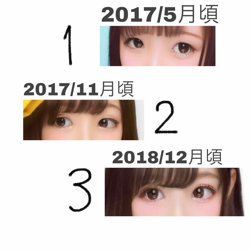 のびーるアイテープ（絆創膏タイプ、レギュラー）/DAISO/二重まぶた用アイテムを使ったクチコミ（1枚目）