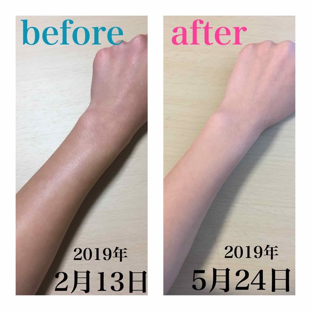 ハトムギ化粧水(ナチュリエ スキンコンディショナー R )/ナチュリエ/化粧水を使ったクチコミ(1枚目)