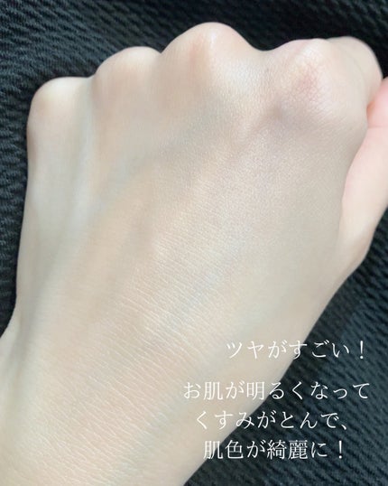 yuuð¿ããã©ãã100ã on LIPS ãããã°ãã¯âºïžçŸå®¹åž«æŽ10幎以äžã®yuuã§ãïŒETVOSã®ããª..ãïŒ8æç®ïŒ