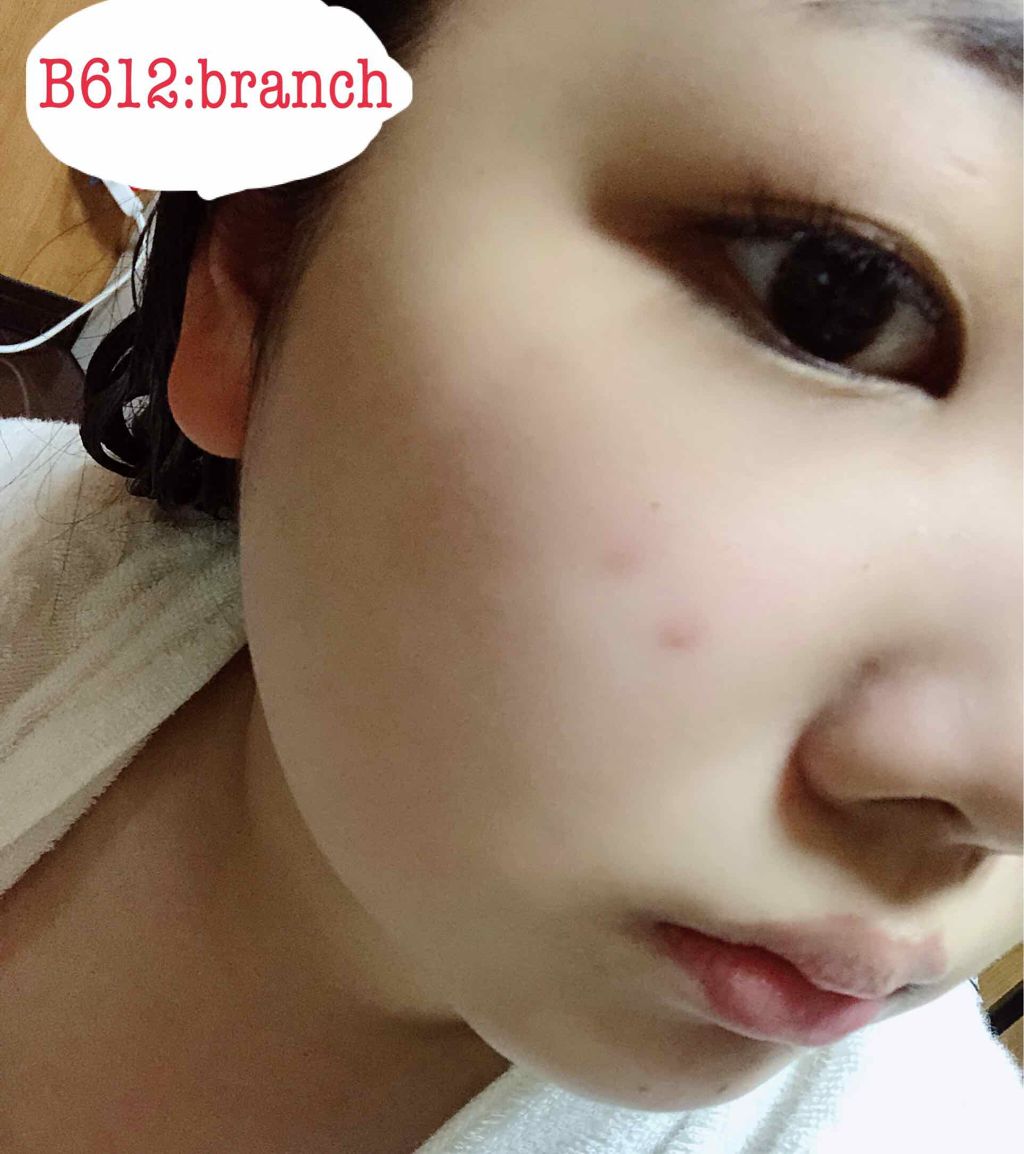 メラノCC 薬用しみ集中対策液(旧)/メラノCC/美容液を使ったクチコミ(3枚目)