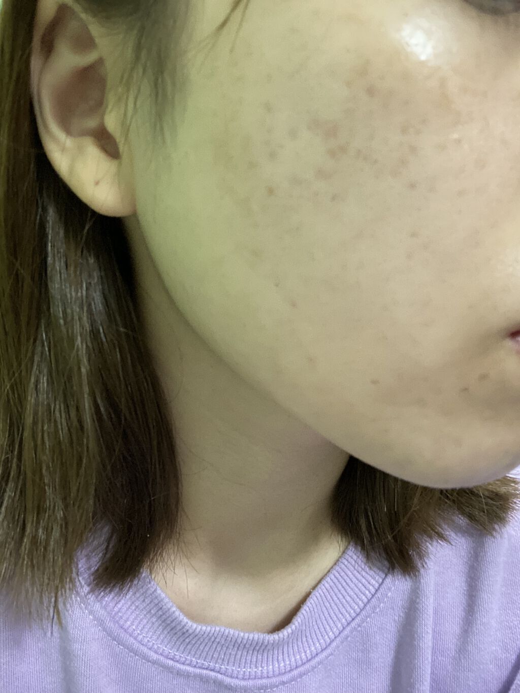 モイスチャー リッチローション(とてもしっとり)/アルージェ/化粧水を使ったクチコミ（2枚目）