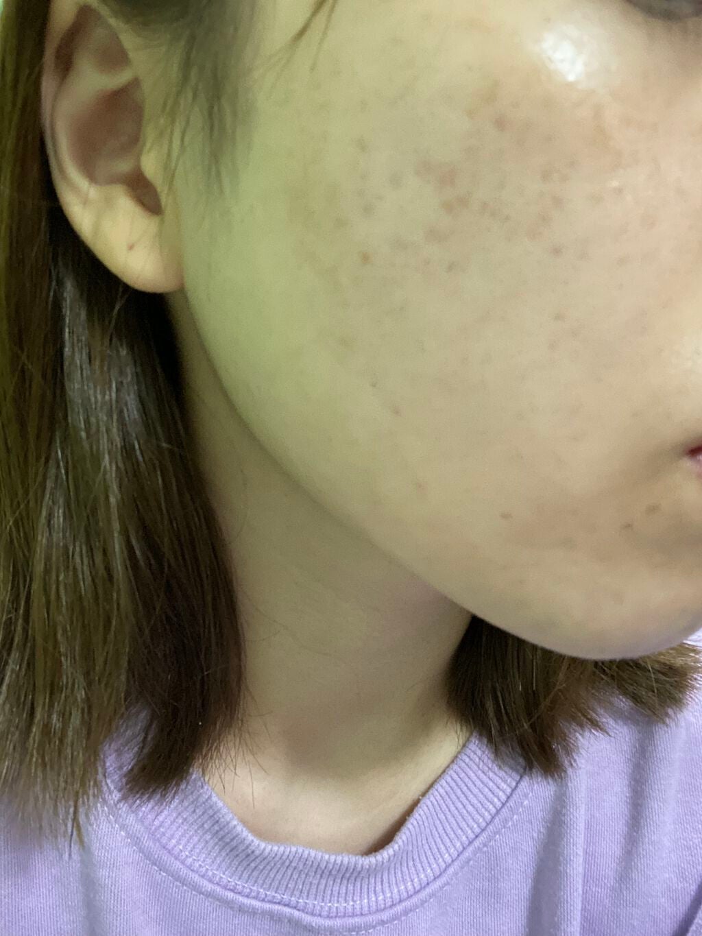 モイスチャー リッチローション(とてもしっとり)/アルージェ/化粧水を使ったクチコミ(2枚目)