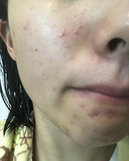 EclatCharme(エクラシャルム)/FABIUS/オールインワン化粧品を使ったクチコミ(4枚目)