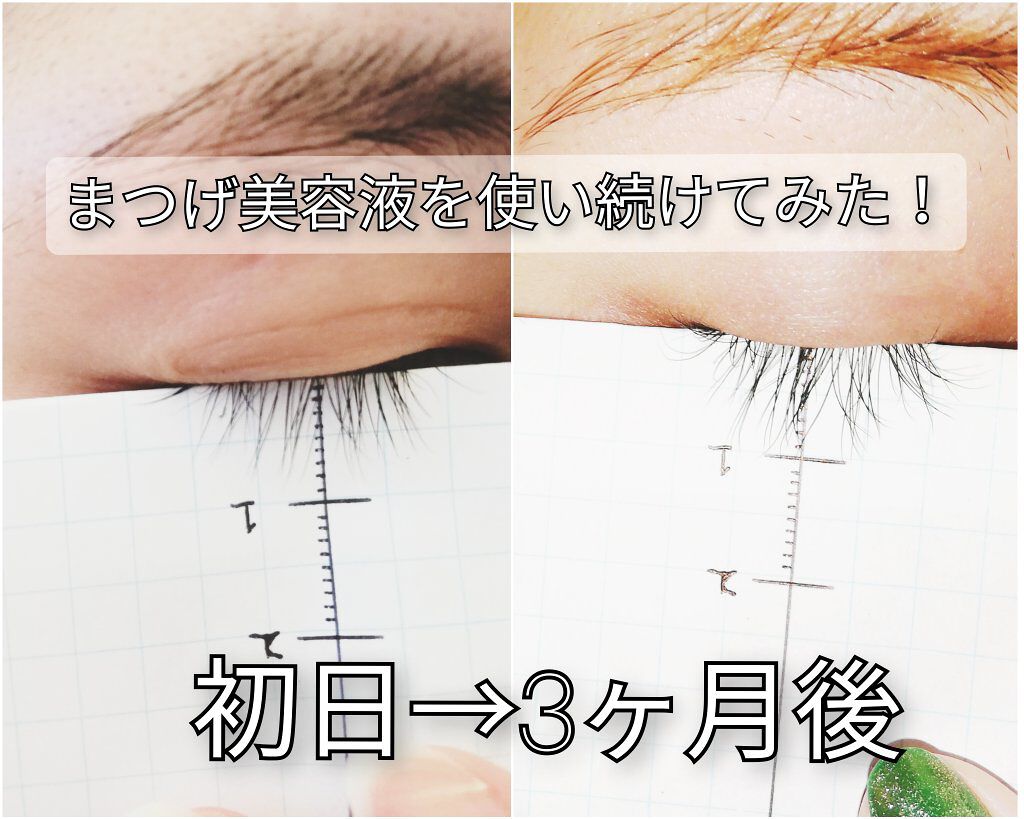 EMAKED(エマーキット)/水橋保寿堂製薬/まつげ美容液を使ったクチコミ(1枚目)