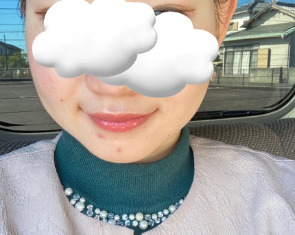 ウォンジョンヨ キャンディーグロウティント/Wonjungyo/リップティントを使ったクチコミ(2枚目)