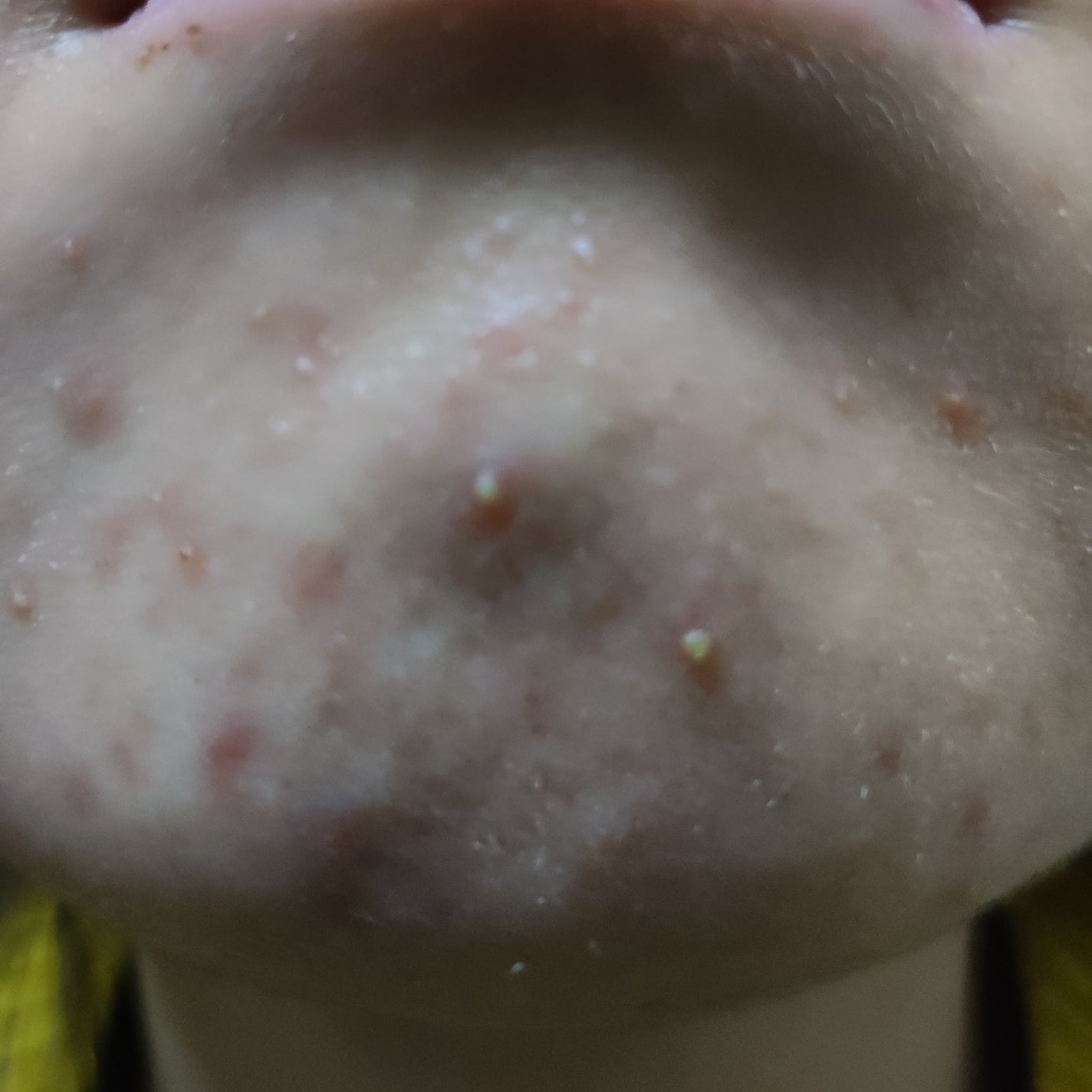 日 記 帳 on LIPS 「衝動で始めましたこのアプリ 頼むから垢バレだけはやめてください..」(3枚目)