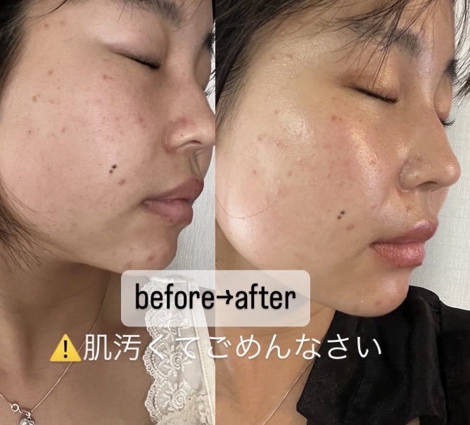 ナチュラルホワイトニングサンガードクリームオリジン/MIGUHARA/日焼け止めクリームを使ったクチコミ（2枚目）