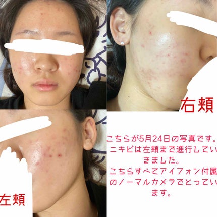 化粧水・敏感肌用・高保湿タイプ/無印良品/化粧水を使ったクチコミ(3枚目)