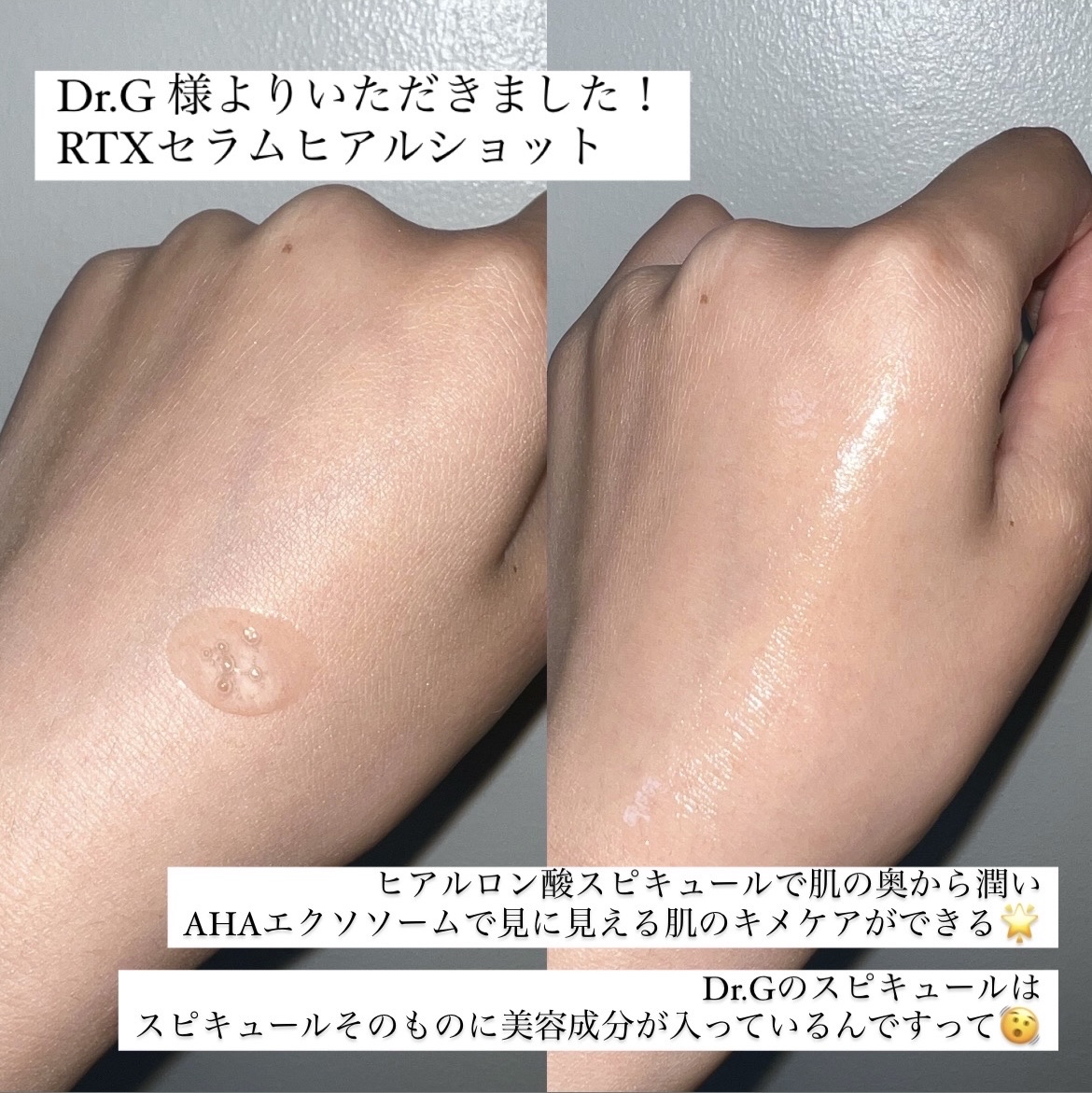 レッドブレミッシュ クリアスージングクリーム/Dr.G/フェイスクリームを使ったクチコミ（2枚目）