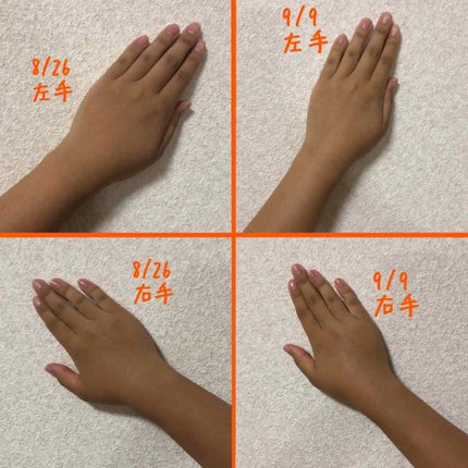 薬用美白 美容液/DAISO/美容液を使ったクチコミ(3枚目)