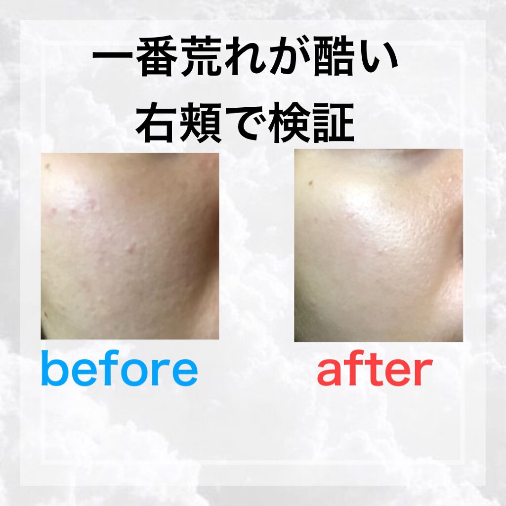 ハトムギ保湿ジェル(ナチュリエ スキンコンディショニングジェル)/ナチュリエ/美容液を使ったクチコミ（3枚目）