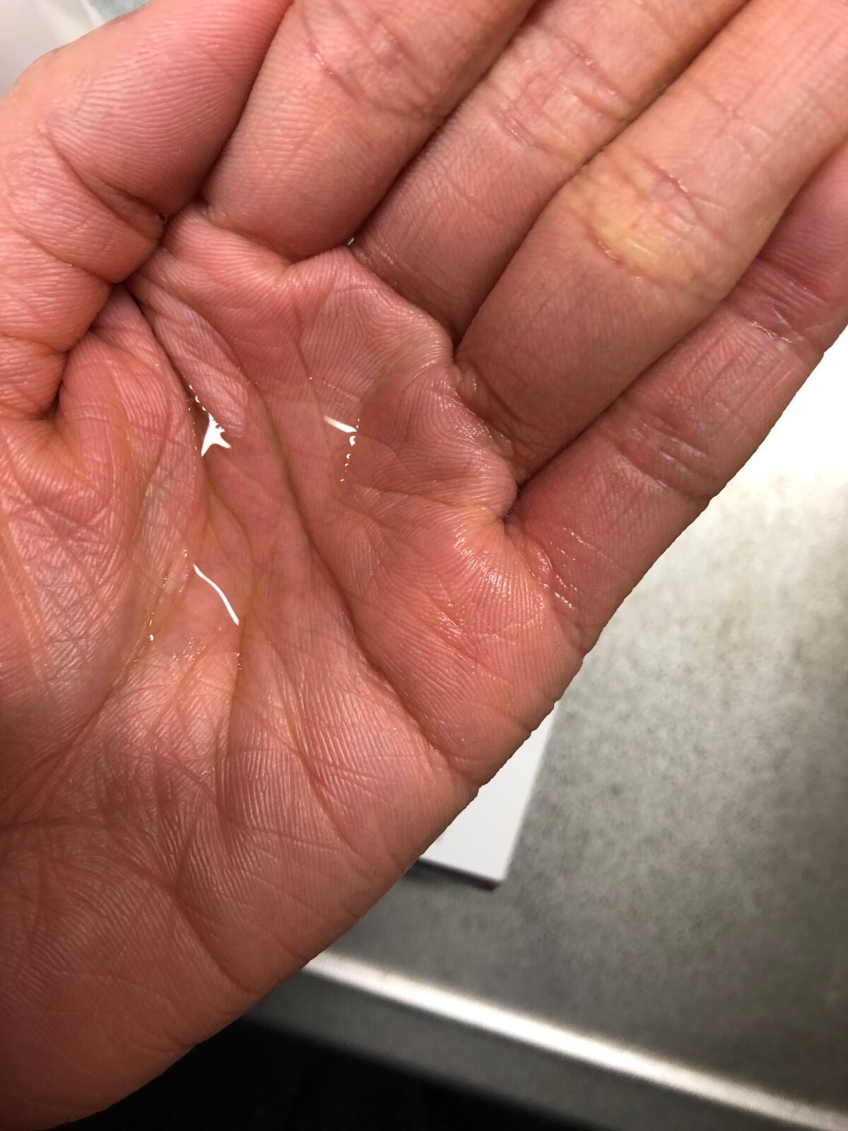 ナインセンス ジェントル スキン クリアローション/NINE SENSE PHYTOLIFT/化粧水を使ったクチコミ(2枚目)