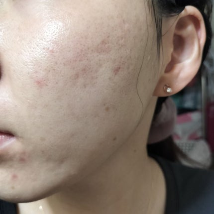 ããã ã®åç²§æ°Ž(ããã¥ãªãš ã¹ãã³ã³ã³ãã£ã·ã§ã㌠R )/ããã¥ãªãš/åç²§æ°Žã䜿ã£ãã¯ãã³ãïŒ2æç®ïŒ