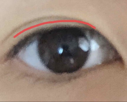 ふたえテープ 目立たず肌になじむ絆創膏タイプ/DAISO/二重まぶた用アイテムを使ったクチコミ(1枚目)