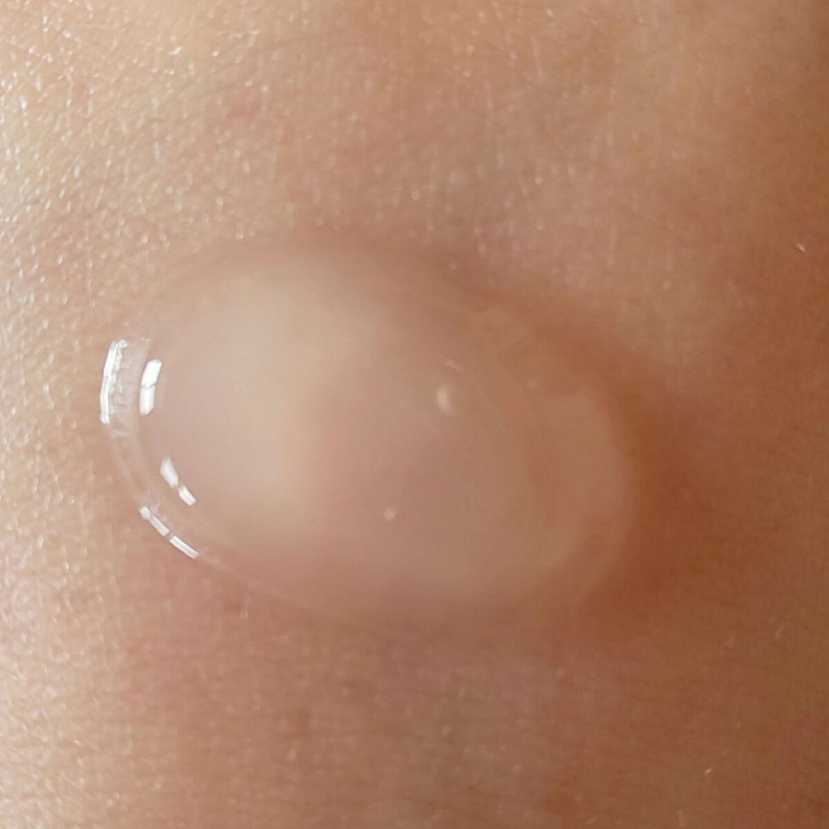 美白乃美人ピーリングジェル/ブレーンコスモス/ピーリングを使ったクチコミ（3枚目）