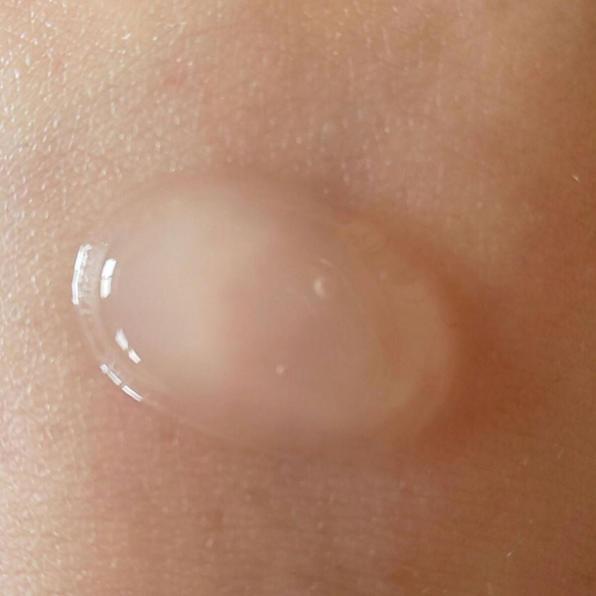 美白乃美人ピーリングジェル/ブレーンコスモス/ピーリングを使ったクチコミ(3枚目)