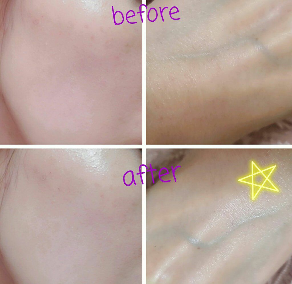 UVã€ã㢠XL ãããã¯ã·ã§ã³ããŒã³ã¢ãã/ã© ããã·ã¥ ããŒ/æ¥çŒãæ¢ãã¯ãªãŒã ã䜿ã£ãã¯ãã³ãïŒ2æç®ïŒ